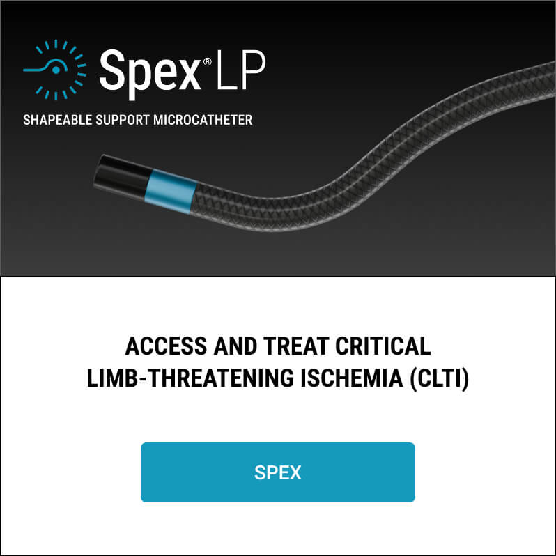 SpexLP Shapeable Support Microcatheter Reflow Medical
